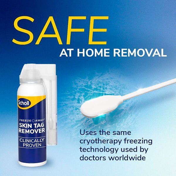 Scholl Freeze Away Skin Tag Remover