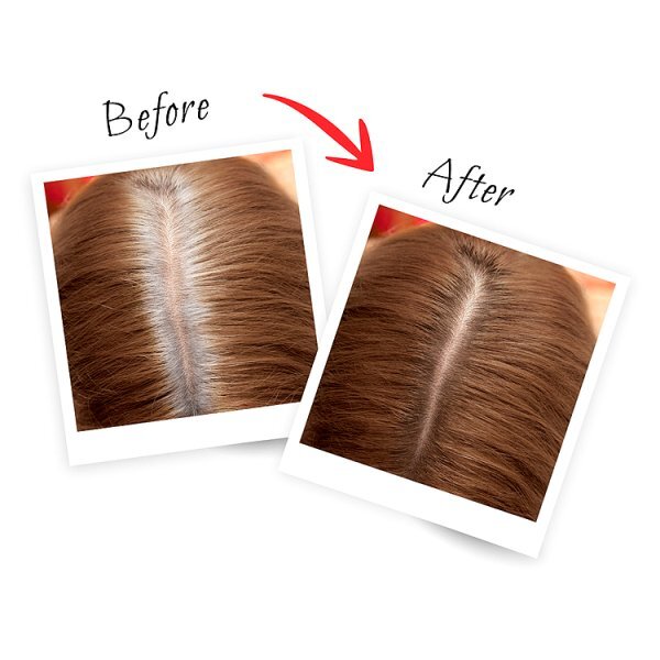 L'Oreal Paris Magic Retouch Dark Blonde Root Touch Up 150ml