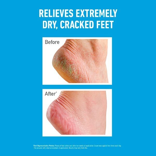 O'Keeffe's Healthy Feet Foot Cream 91g
