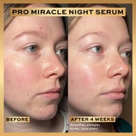 Revolution Pro Miracle Night Rescue Serum