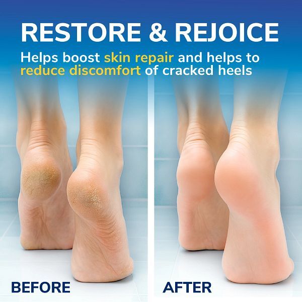 Dr. Scholl’s Bundle Cracked Heel Repair Cream 60ml x2