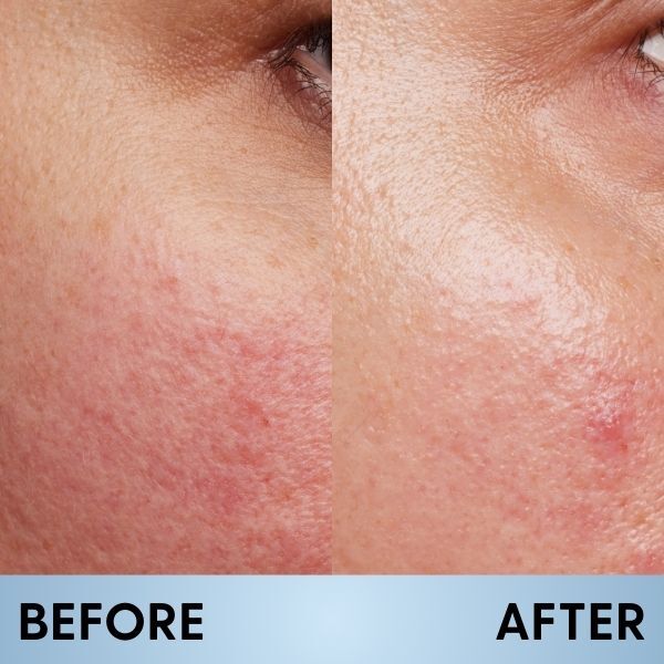 Optimum Collagen Day Cream 50ml