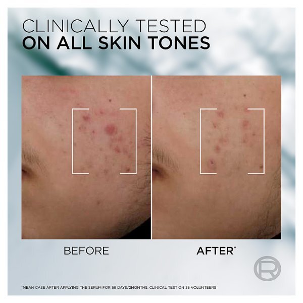 L'Oréal Men Expert Derma Control Anti-Blemish Serum 3% Niacinamide