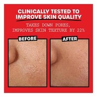 Thayers Hydrating Alcohol-Free Facial Toners - Cucumber