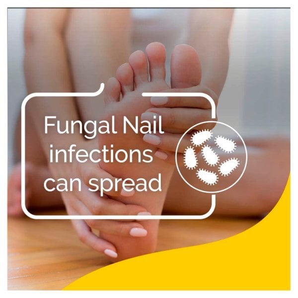 Scholl Nail Fungal Weekly Treatment Kit