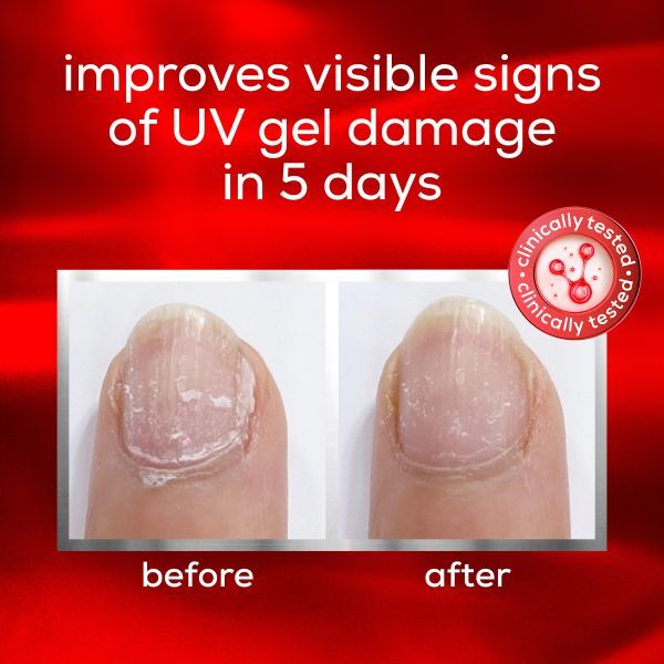 Essie To The Rescue UV Gel Damage Repair Nail Treatment