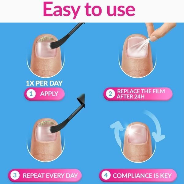 Excilor Ultra Nail Fungus Treatment