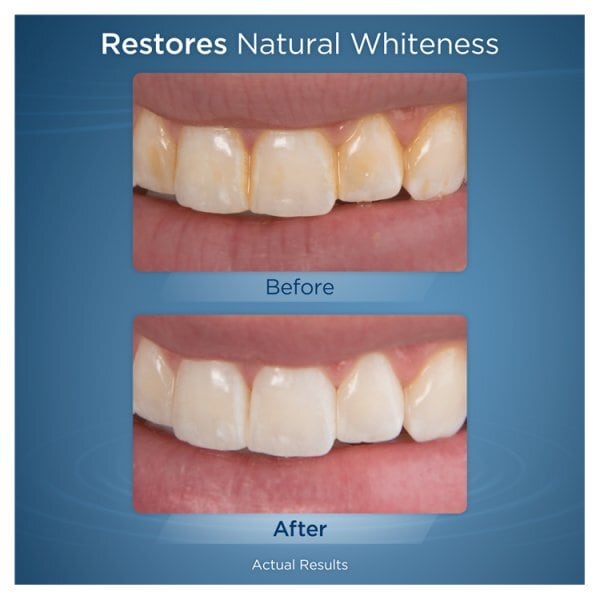 Waterpik Whitening Water Flosser WF-06