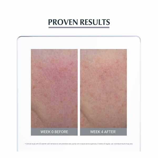 Eucerin Anti Redness Soothing Cream 50ml