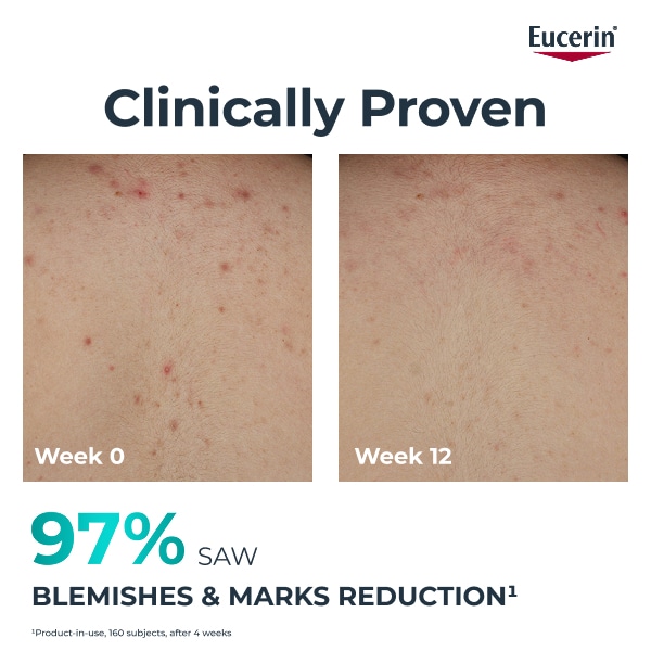 Eucerin DermoPure Clinical Correcting Body Care 200ml