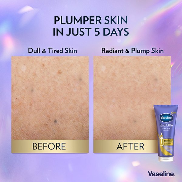 Vaseline Gluta-Hya Overnight Radiance Serum Burst Lotion 200 ml