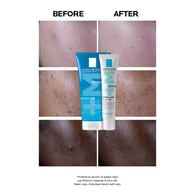 La Roche-Posay Effaclar Duo+M Anti-Blemish Moisturiser 40ml