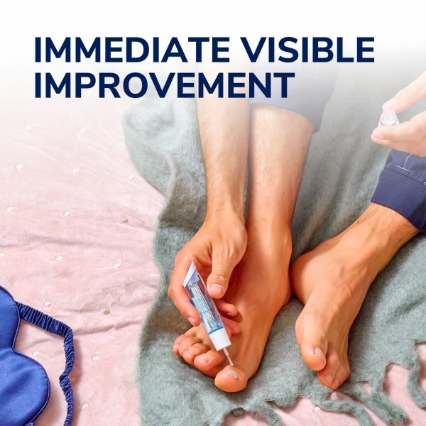 Dr. Scholl’s Bundle Fungal Nail Treatment System & Antifungal spray