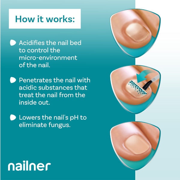 Nailner Active Cover Nail Fungus Treatment Natural Nude