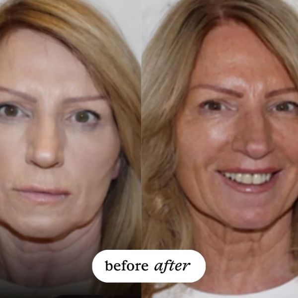 utan Coconut Tanning Water 50% Darker 100ml