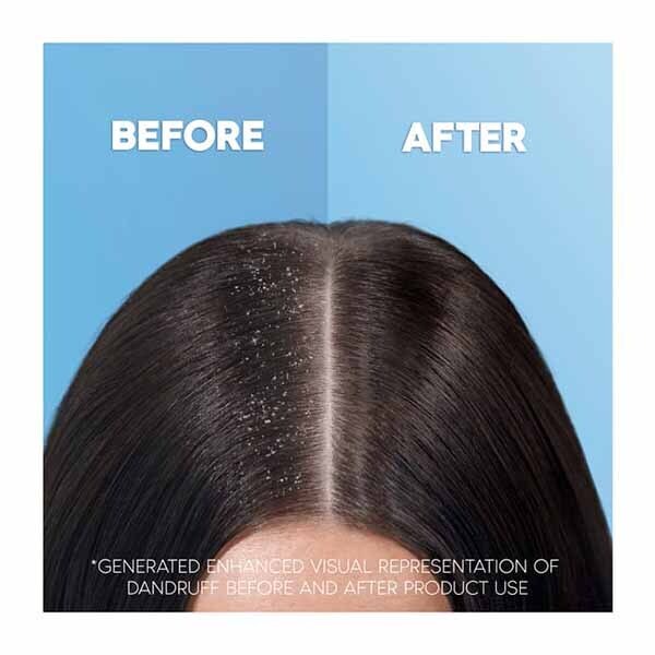 Head & Shoulders Classic Clean Anti Dandruff Shampoo 500ml