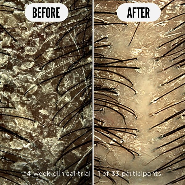 Noughty Care Taker Scalp Soothing Tonic 75ml