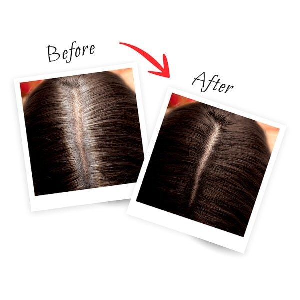 L'Oreal Paris Magic Retouch Dark Brown Root Touch Up 150ml