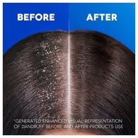 Head & Shoulders Anti Hair Fall Shampoo