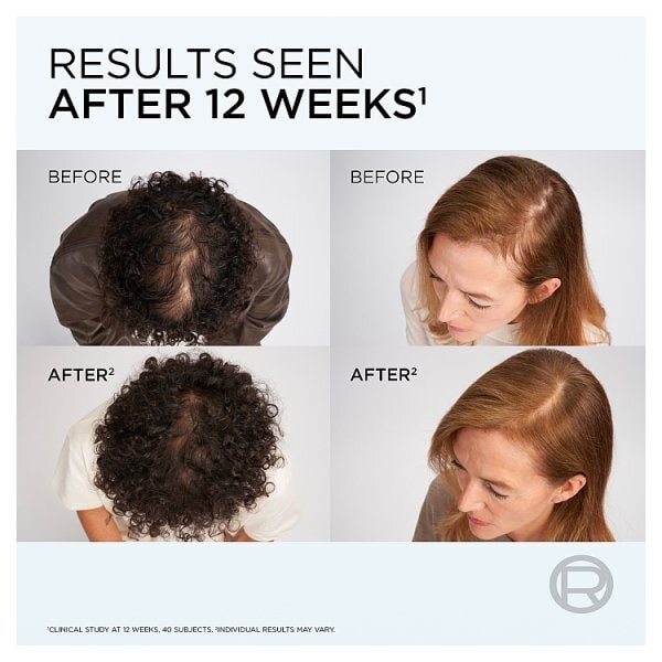 L'Oréal Paris Elvive Growth Booster Anti Hair Loss Shampoo