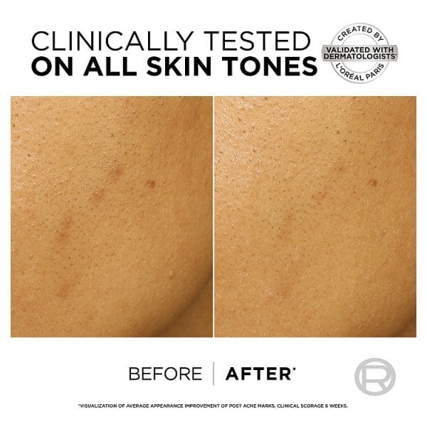 DNR L'oreal Paris Bright Reveal Dark Spot Exfoliant Peel 25Ml