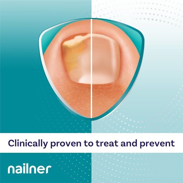 Nailner Fungal Nail Brush 5ml