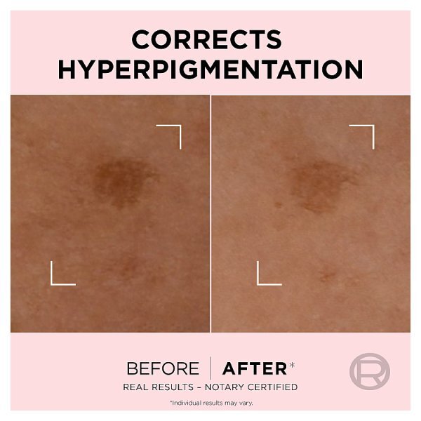 L'Oréal Paris Age Perfect Golden Age Rapid Spot Corrector