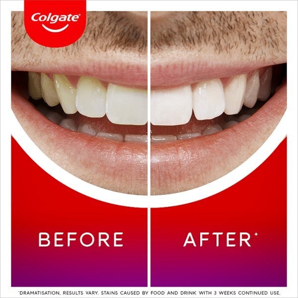 Colgate Overnight Teeth Whitening Serum