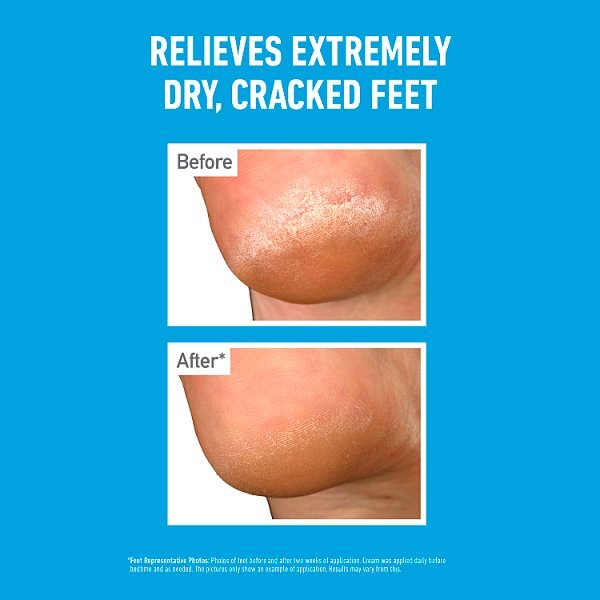 O'keeffe's Healthy Feet Overnight 80Ml