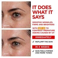 L'Oreal Paris Revitalift Laser Renew Advanced SPF20 50ml