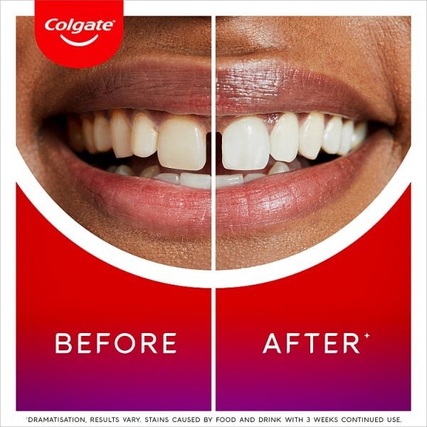 Colgate Max White Ultimate Radiance Toothpaste 75ml