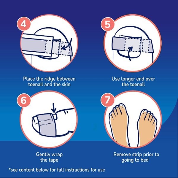 Dr. Scholl's Ingrown Toenail Strips 10 pack