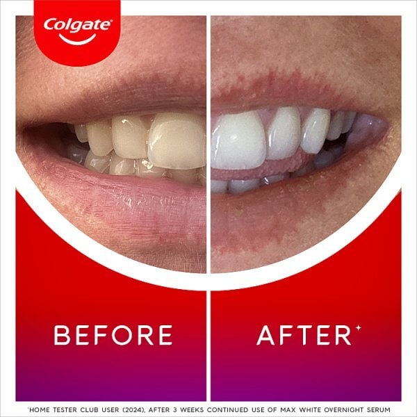 Colgate Overnight Teeth Whitening Serum