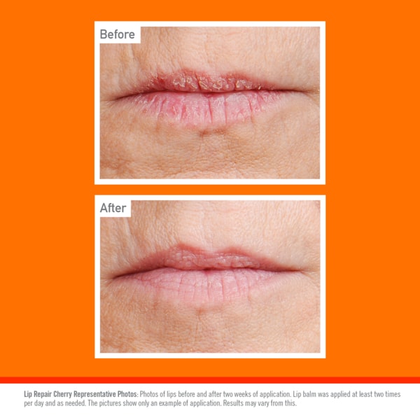 O'keeffe's Lip Repair Cherry Lip Balm 4.2G