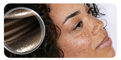 dermoPLP-skin-concerns_hair-concerns