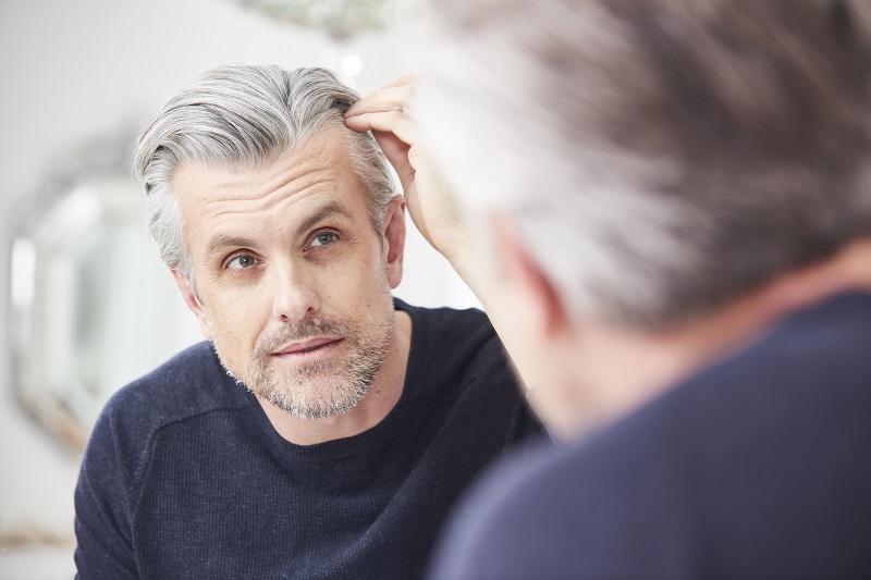 male-hair-loss