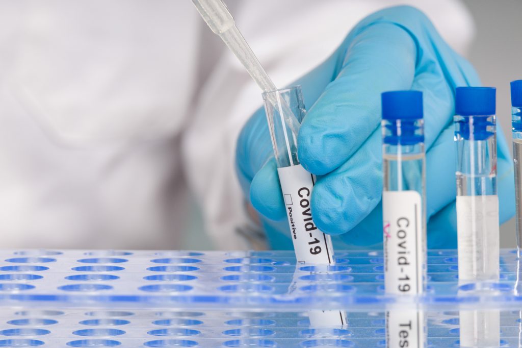 PCR test