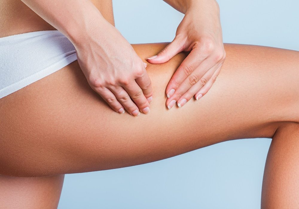 Youn woman squeezing leg to show no cellulite